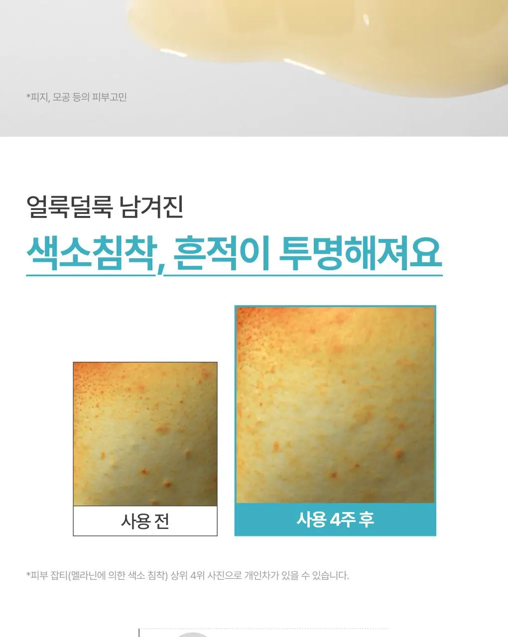 [1+1/깐달걀피부결] 이니스프리 레티놀 시카 흔적 앰플 30ml 더블 기획 상세페이지 16